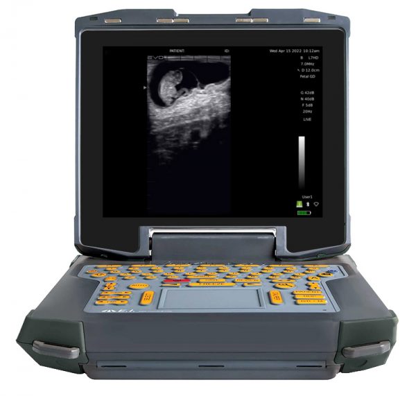 Ibex Evo Ultrasound